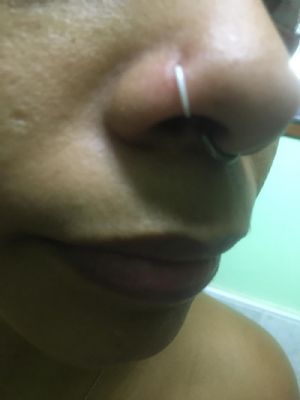 Bioflex Nose Hoop Customer Photo